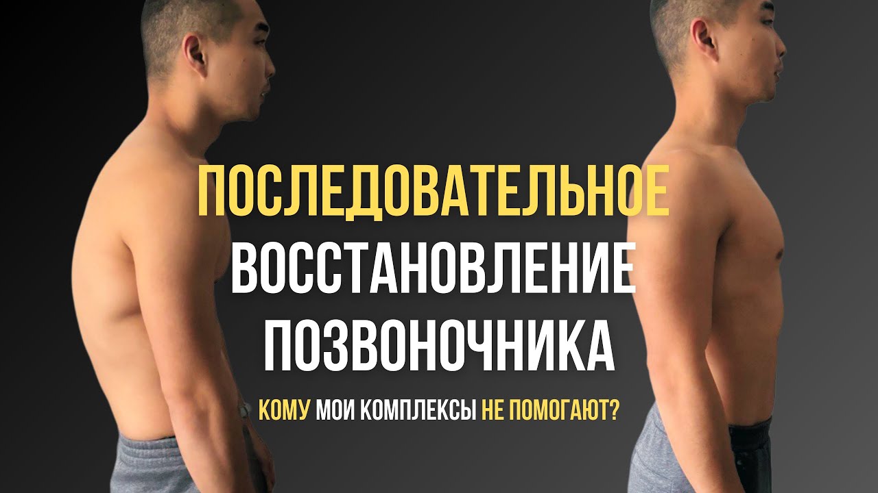 Кифоз грудного отдела | Полное последовательное восстановление