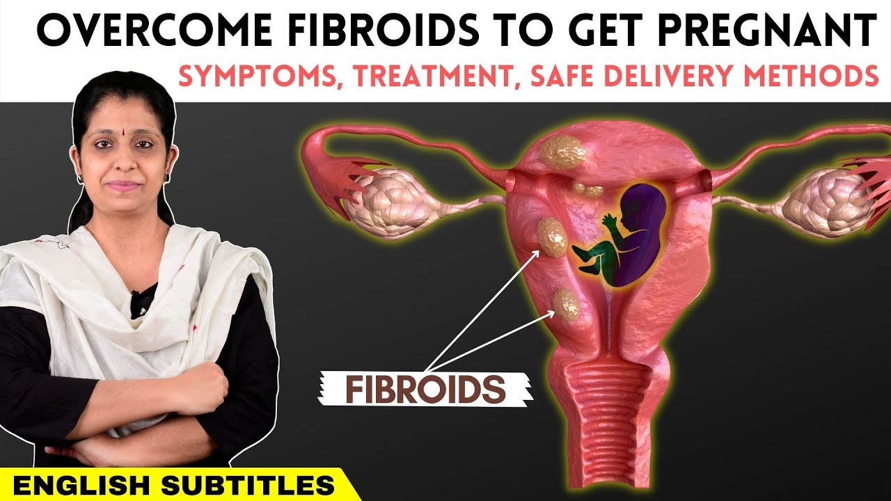 Uterine Fibroids - How to get pregnant | Fibroid கட்டிகள் இருந்தாலும் கர்பமாவது எப்படி?