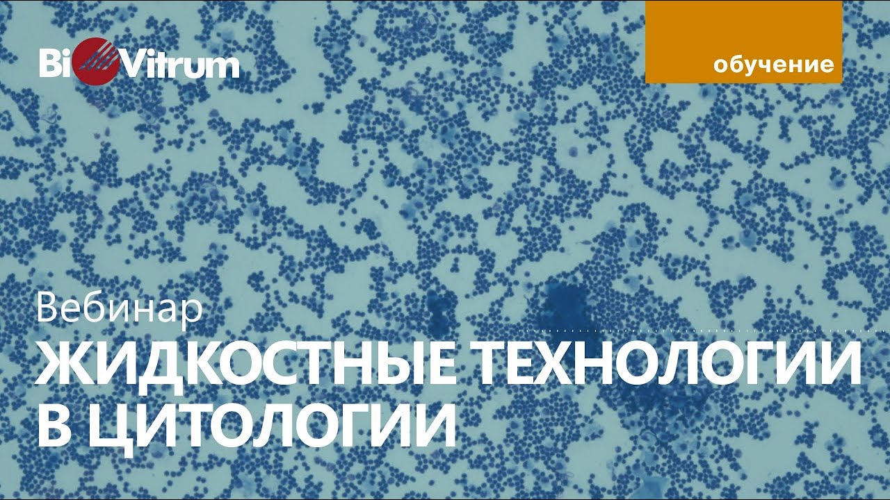 Жидкостная цитология на практике