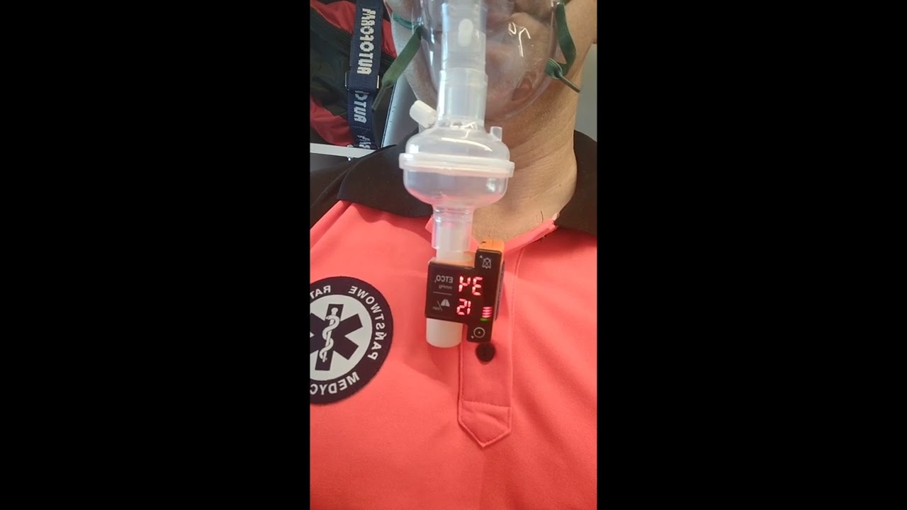 Improwizowane monitorowanie ETCO2 przy pomocy kapnometru EMMA