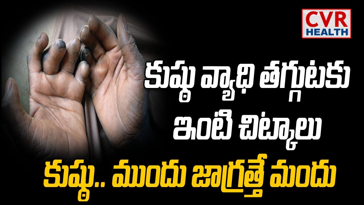 ప్రపంచ కుష్ఠు వ్యాధి దినోత్సవం | Health Awareness | World Leprosy Day | CVR Health