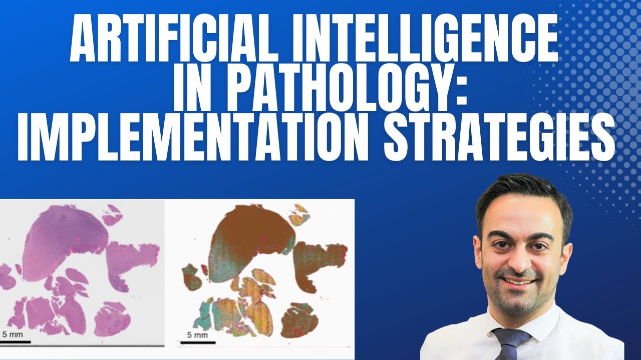 Artificial Intelligence in Pathology : Implementation Strategies