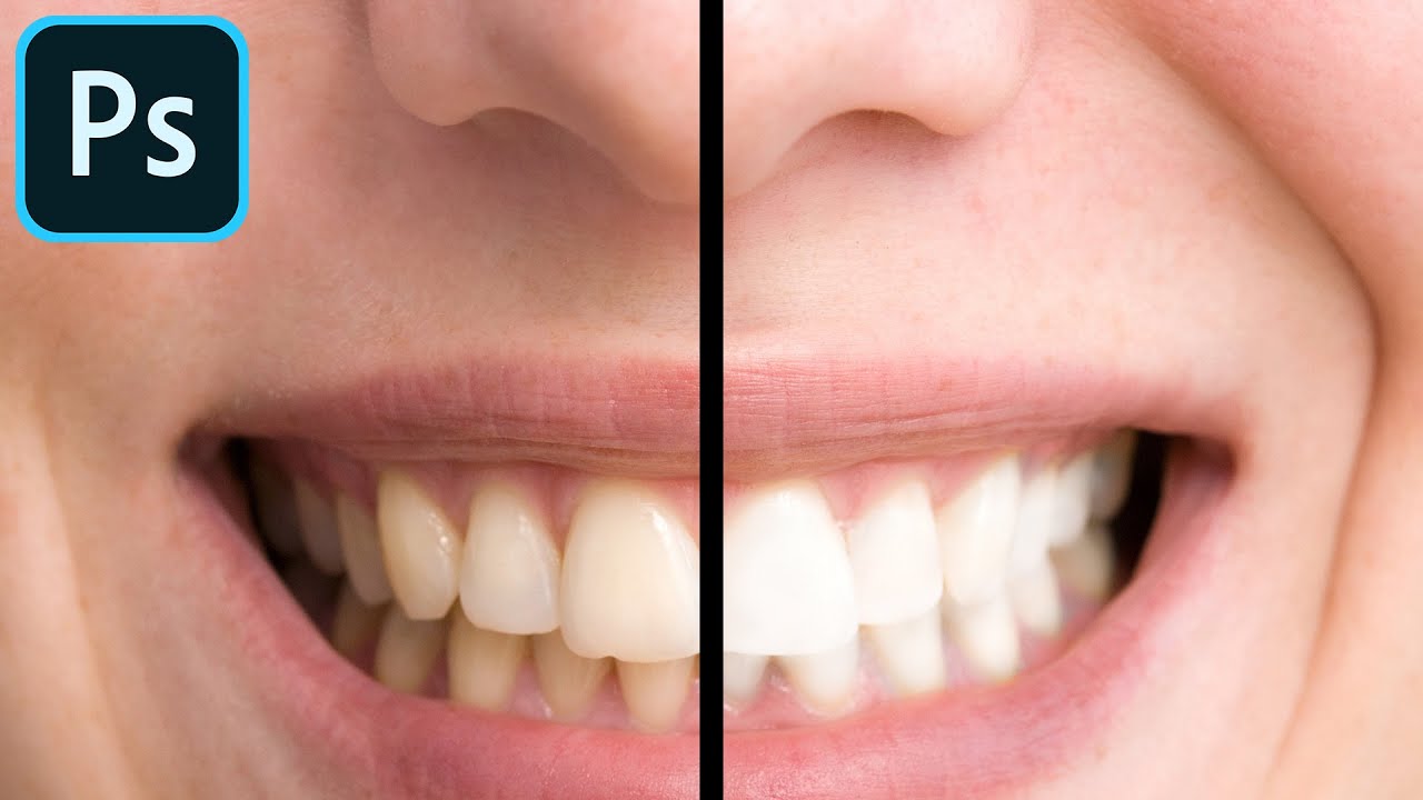 How to Whiten Teeth Using Photoshop