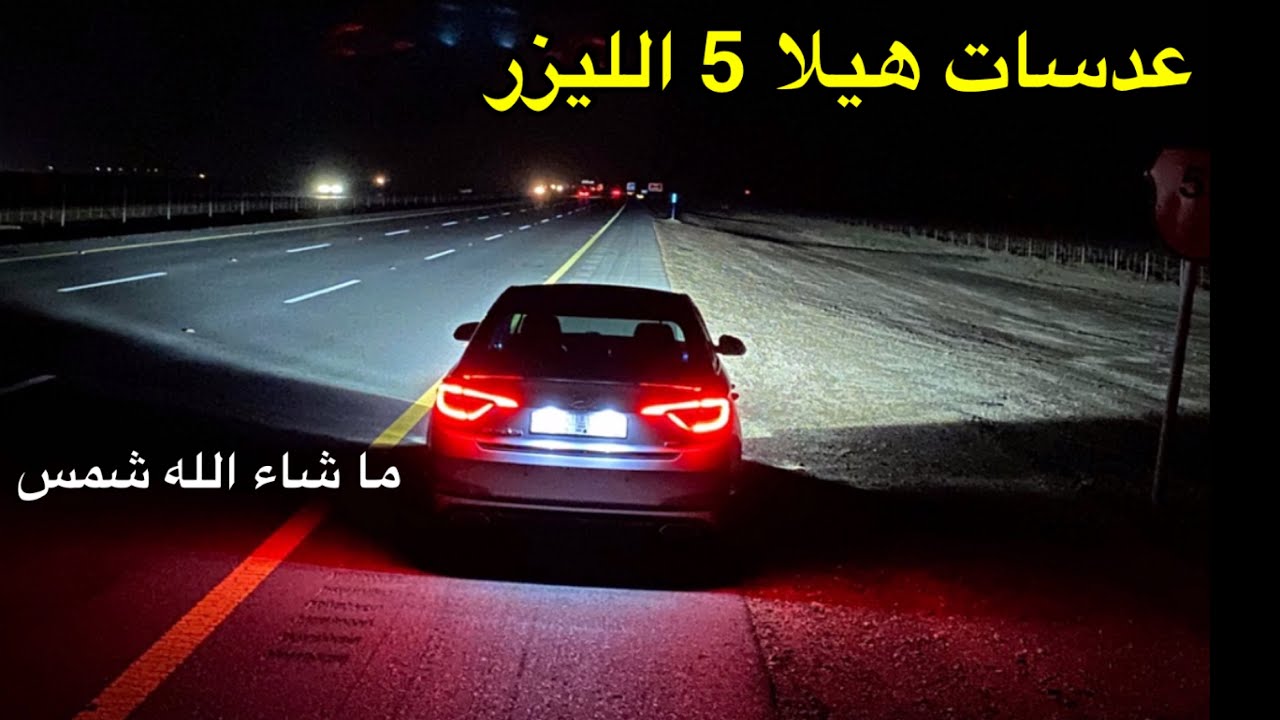 ركبنا عدسات الليزر للسوسو 😍 ما شاء الله