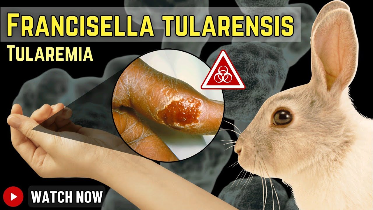 Francisella tularensis: The Deadly Bioterror Bacteria Behind Tularemia & Its Zoonotic Threats