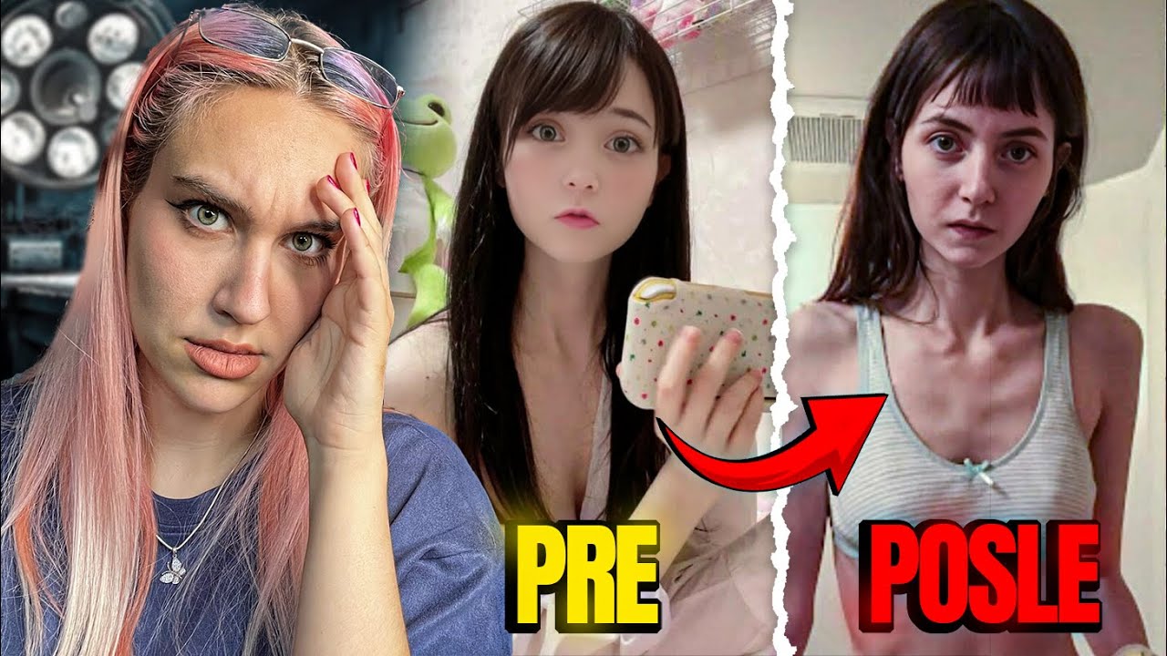 NATERALI je da živi kao PLASTIČNA LUTKA 😨 Slučaj Venus Angelic
