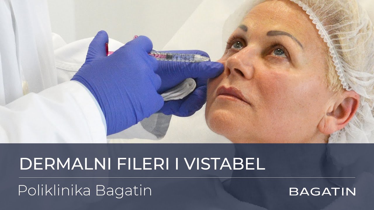 Tretmani dermalnim filerima Juvéderm i Vistabel -  Poliklinika Bagatin