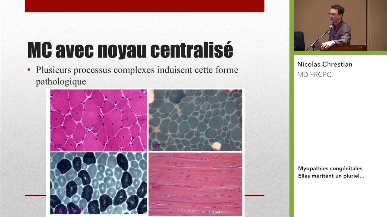 Myopathies congénitales : Elles méritent un pluriel… avec Nicolas Chrestian | DMC - MDC