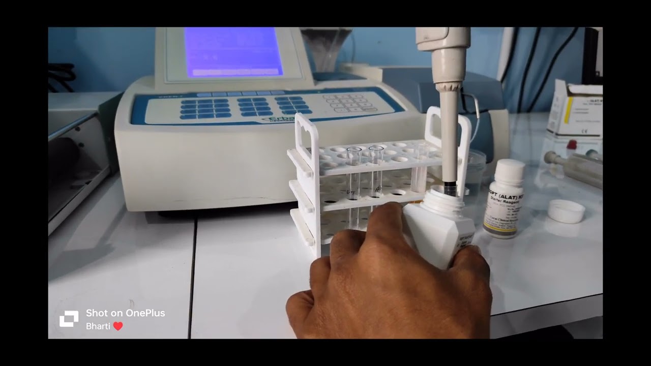 SGPT Blood Test #Liver Function Test # Erba biochemistry Analyzer Chem _7@DiagnoLearn