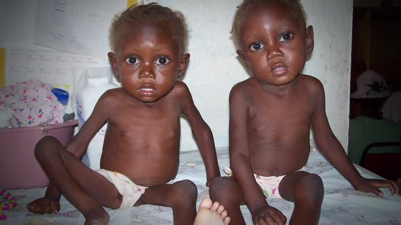 The History of Feed My Starving Children