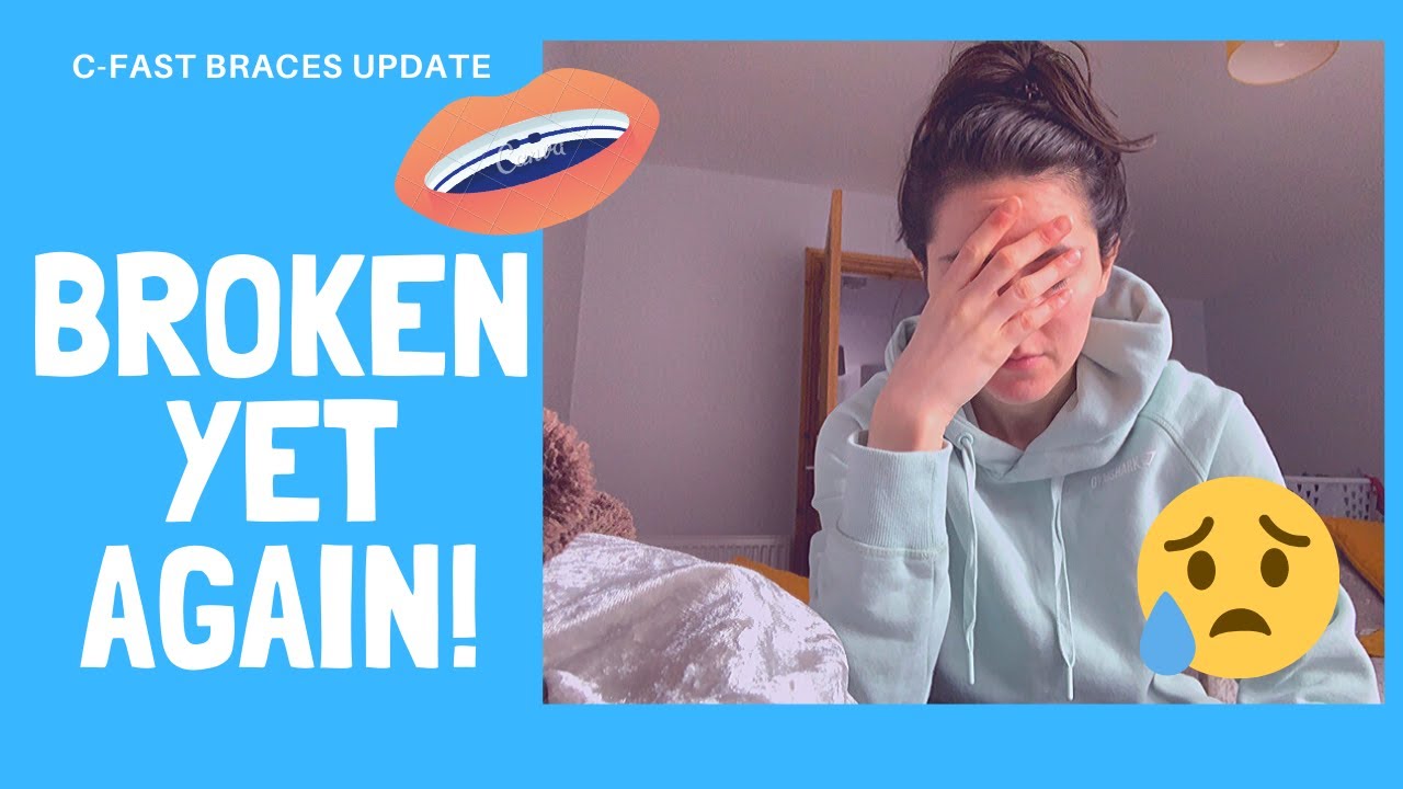 CFast Braces update - broken... AGAIN! *fed up*