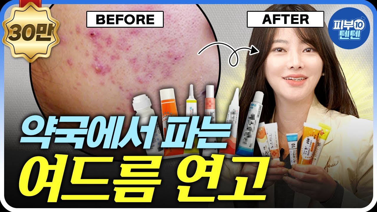 NO광고..🚨 직접 효과본 트러블, 블랙헤드, 색소침착 타파 찐찐 약국연고템! | 여드름 흉터 연고  여드름자국 흉터치료 노스카나 에스로반 아젤리아 클리어틴 지성피부