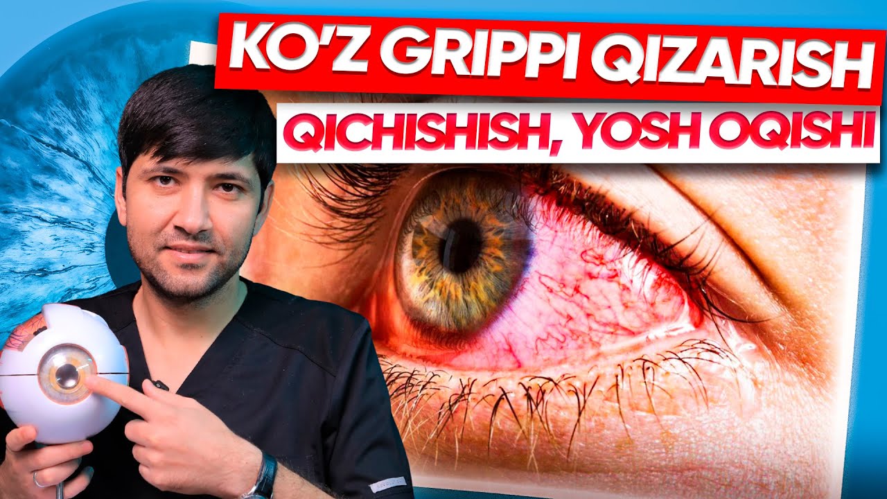Ko‘z grippi: belgilari, sabablari va to‘g‘ri davolash
