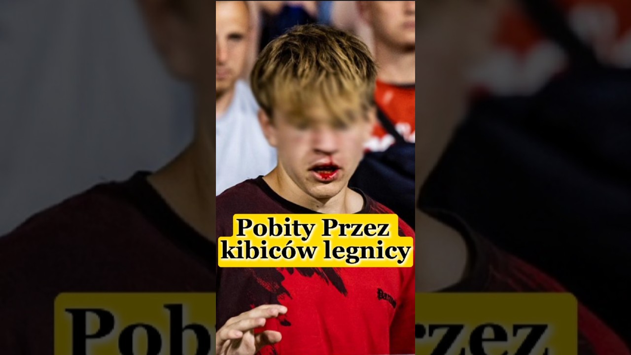 Pobity#Kibic#Wisły Krak&oacute;w