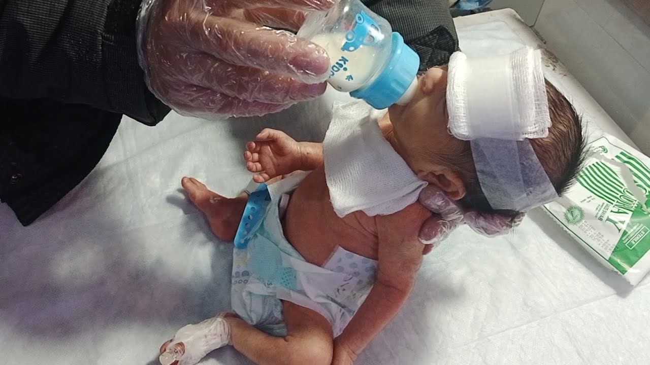 Tiny Fighter’s First Feeding | Premature Baby Journey #preamture #newbornbaby #baby #cute #newborn 