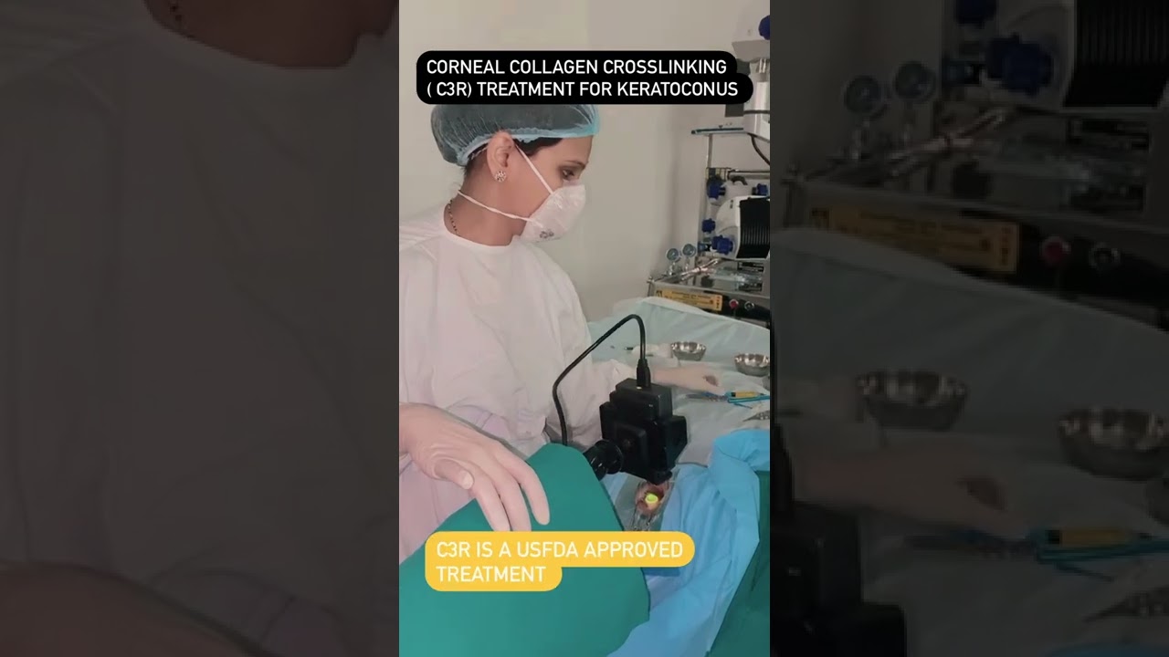 C3R (Corneal Collagen Crosslinking) for Keratoconus - CLIO Eye Care