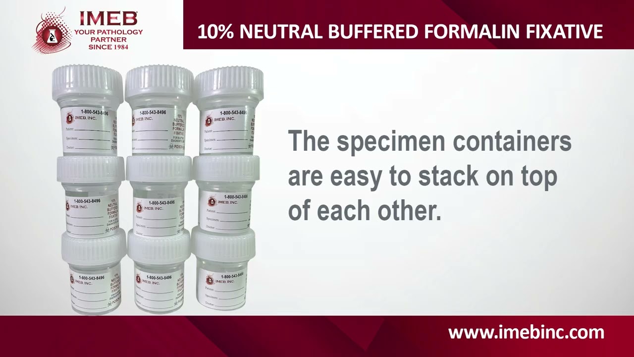 IMEB Prefilled 10 Percent Neutral Buffered Formalin Fixative in Lockable Containers