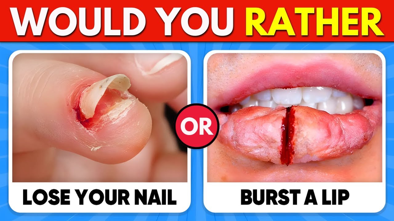 Would You Rather...? EXTREME Edition 😱 100 HARDEST Choices Ever!