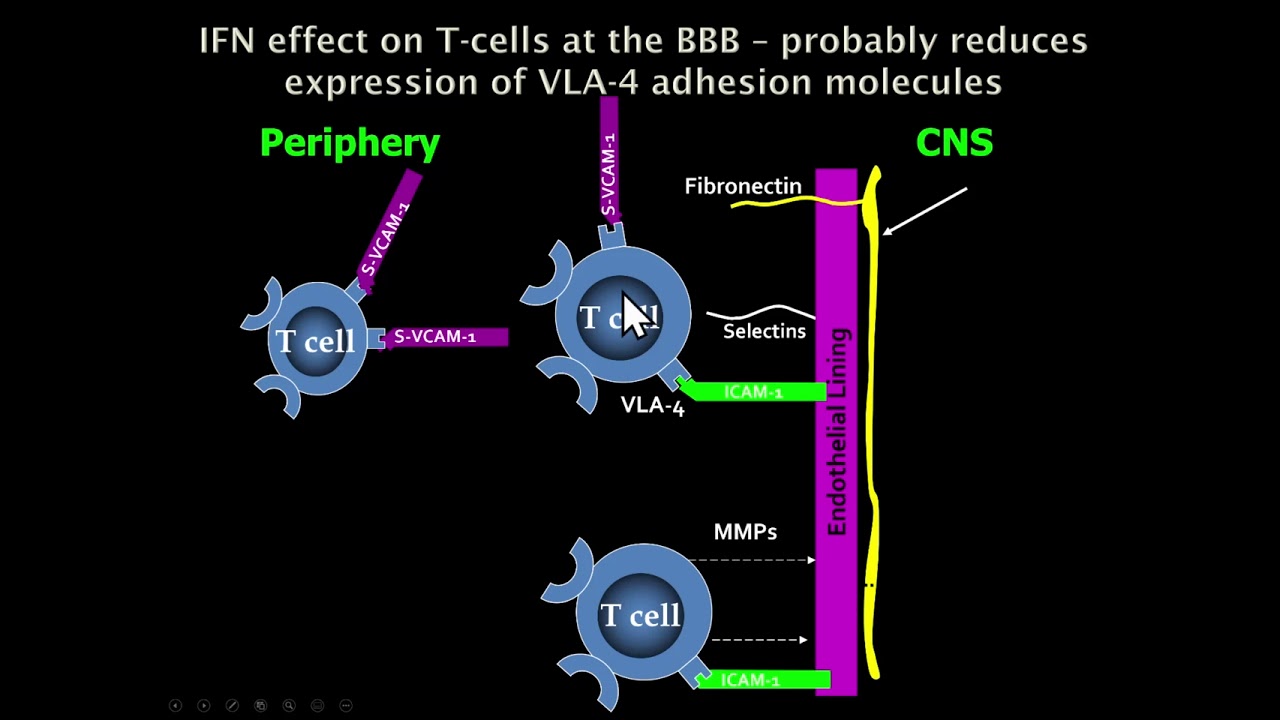 13. Quick Reviews: CNS Demyelinating and Dysmyelinating diseases