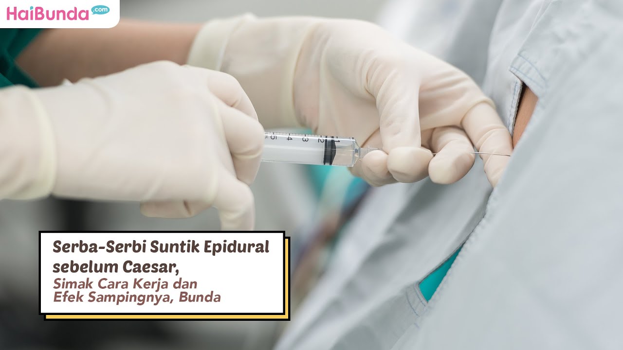 Serba-Serbi Suntik Epidural sebelum Caesar, Simak Cara Kerja dan Efek Sampingnya, Bunda