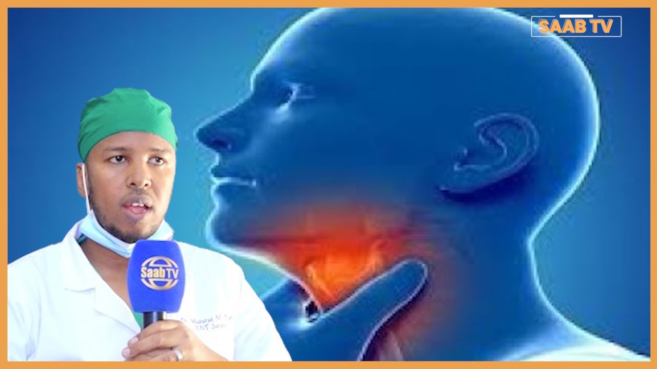 Caafimaadka:  Xanuunada Ku Dhaca Cunaha Iyo Qaabka Looga Hortagi Karo