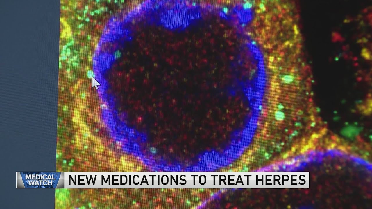 New medications to treat herpes &mdash; and more health headlines