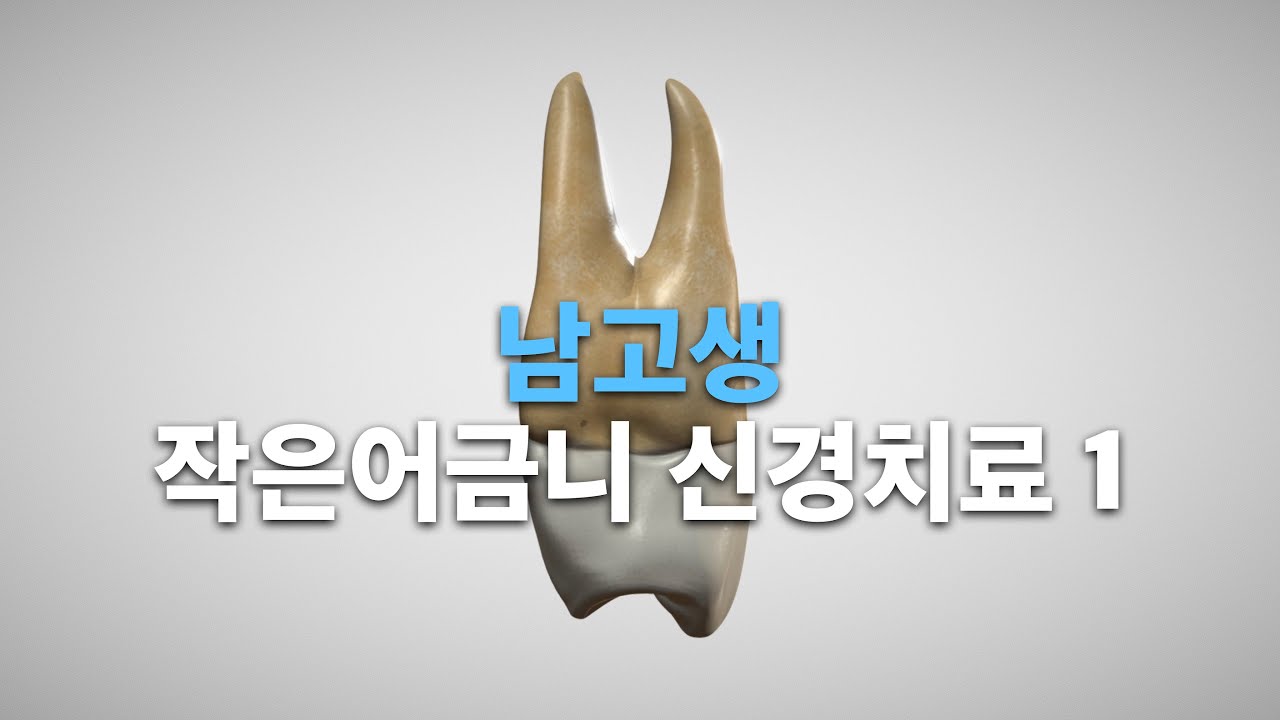 남고생의 상악소구치 근관치료 첫째 날 (#25)