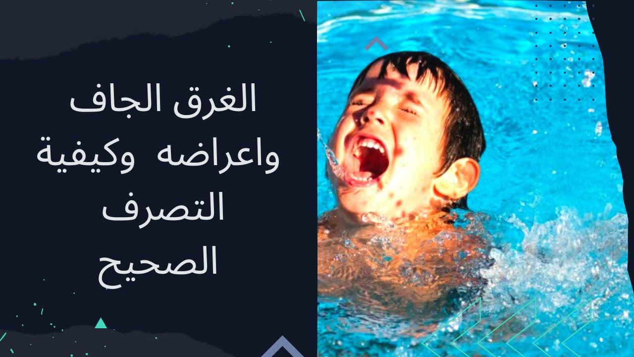 الغرق الجاف واعراضه وكيفية التصرف الصحيح