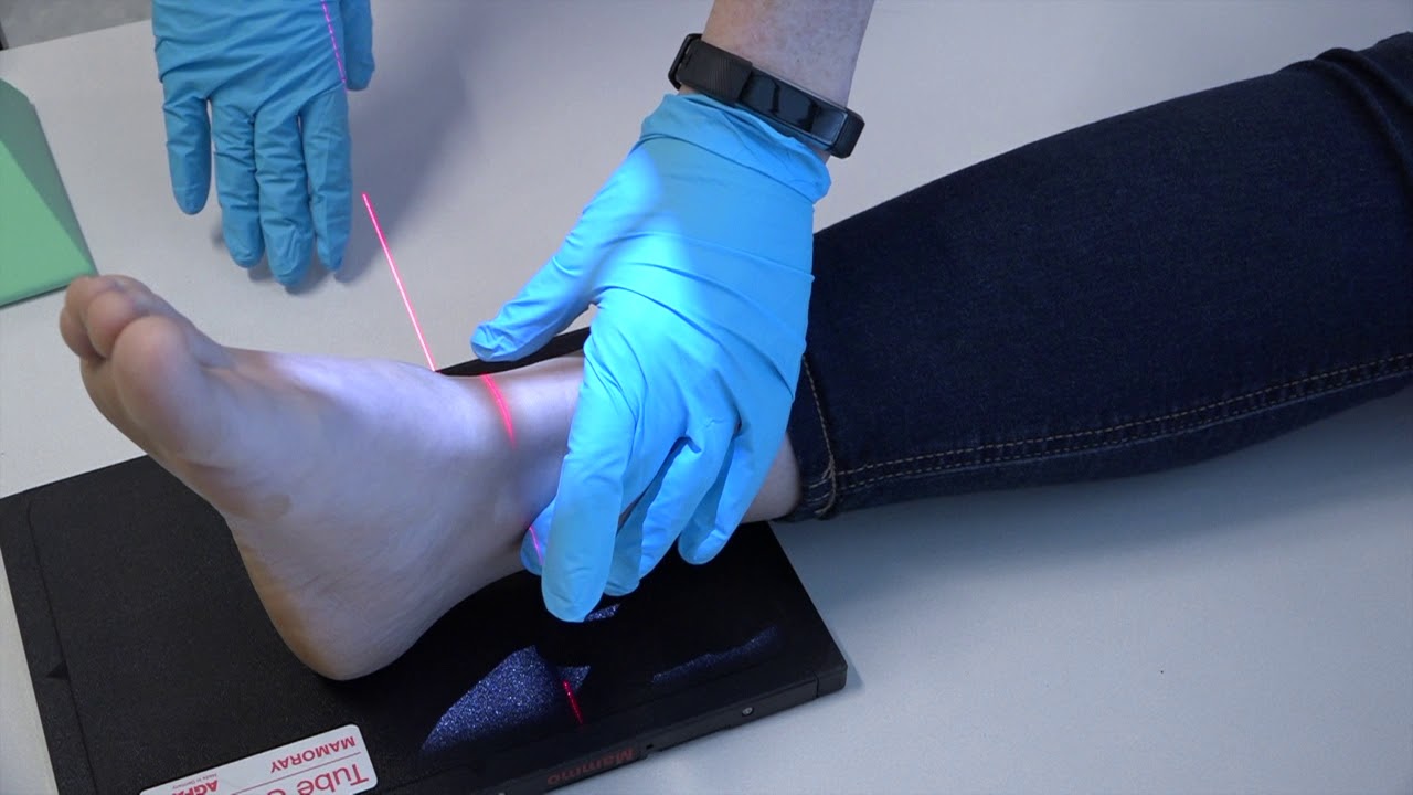 Ankle X Ray