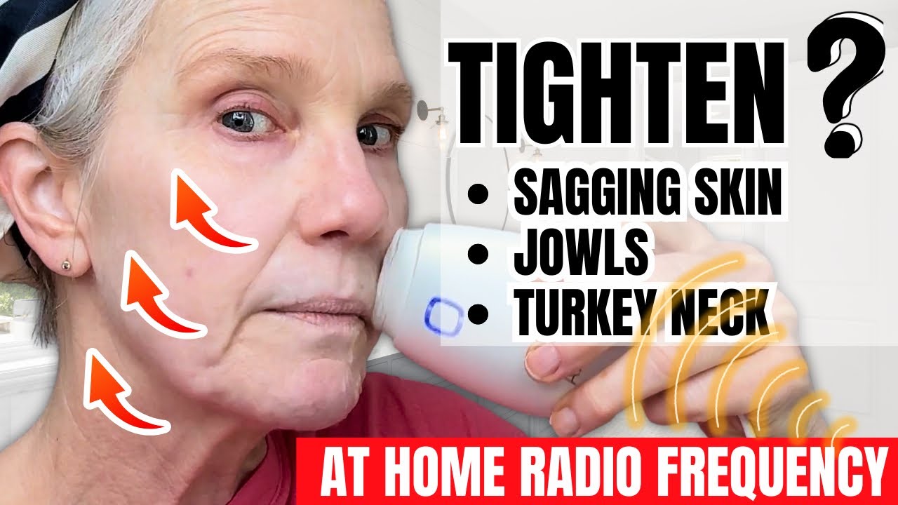 Home Radio Frequency for Mature Sagging Skin? — Testing the NEWA Device - (1st Impressions)