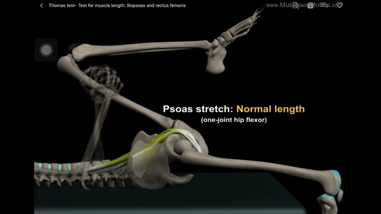Thomas Test Assessment of hip flexors length