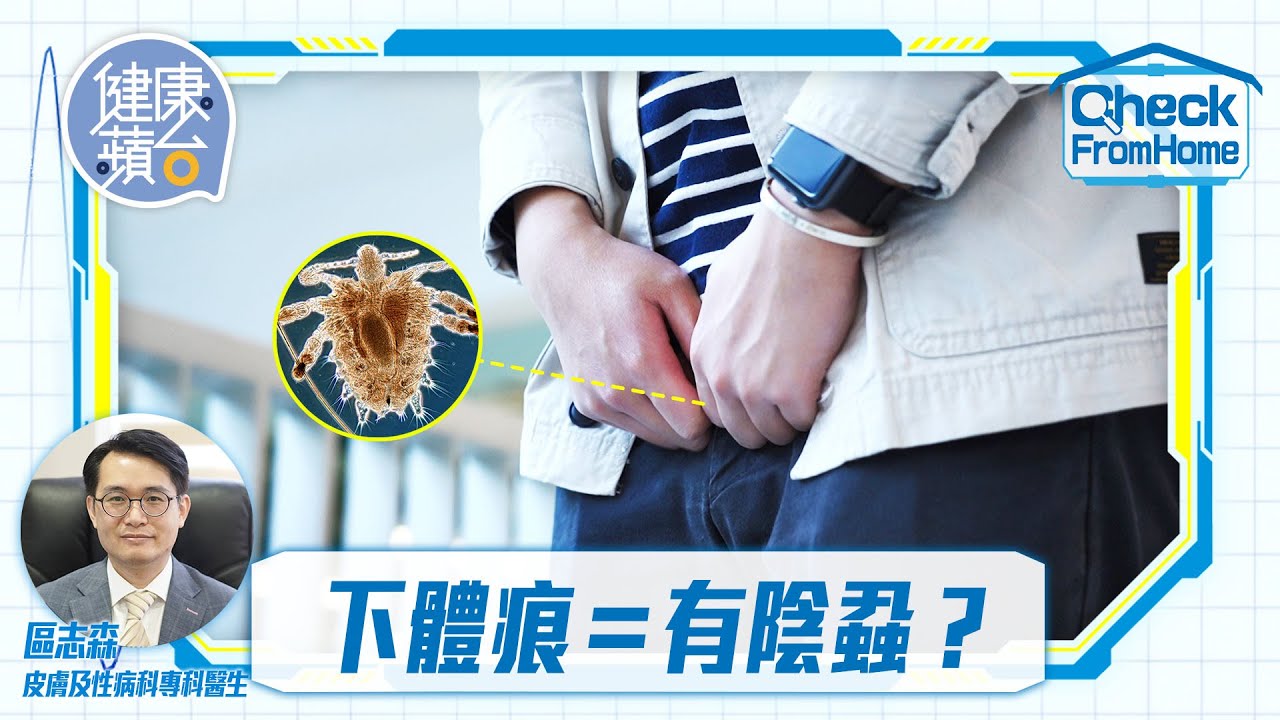 性病｜下體痕癢或是陰蝨作怪 醫生提醒傳染途徑唔只性接觸一種 #checkfromhome #健康蘋台─果籽 香港 Apple Daily─原刊日期：20210411