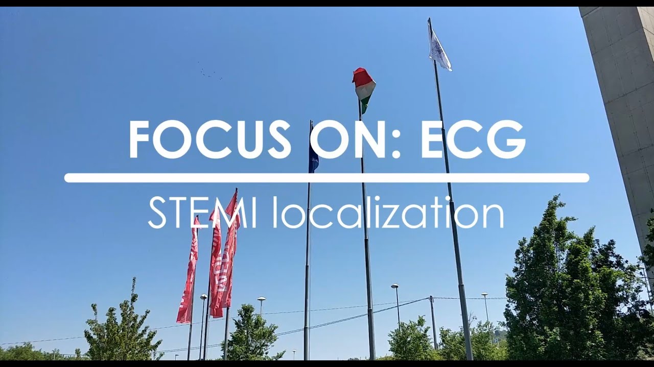 Focus on ECG: STEMI localization