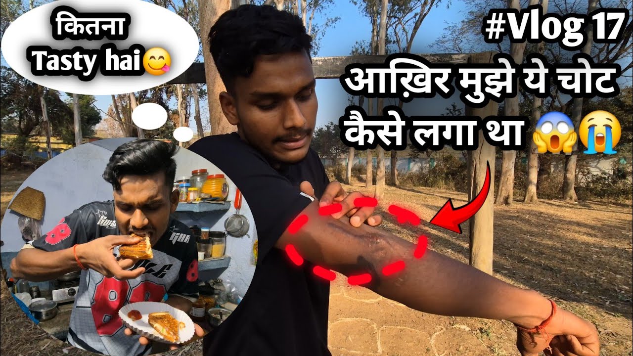 Aakhir Mujhe ye Chot 🩹 Kaise Lagi थी 😭 or Upar se Sham 🌆 ko Sandwitch 🥪 khane chala gya😋 #Vlog17📸  