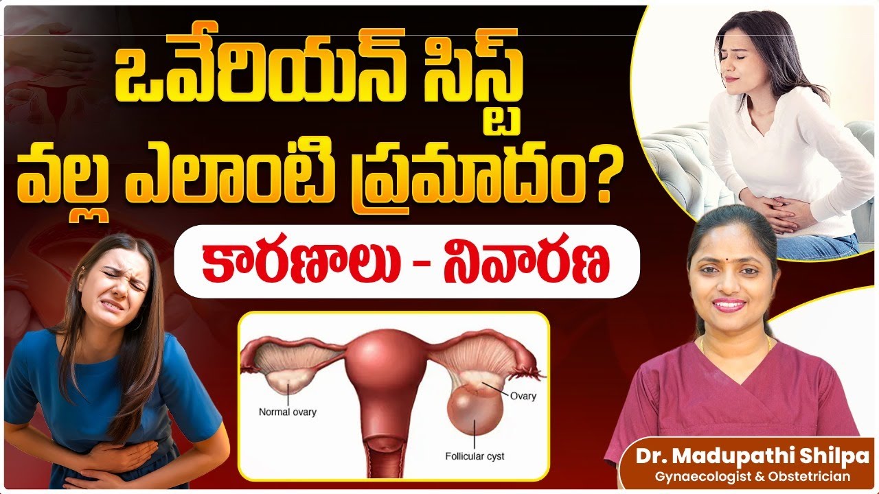 Ovarian Cyst Symptoms in Telugu | Types of Ovarian Cyst | Ovarian Cyst Treatment | Dr Shilpa Womens