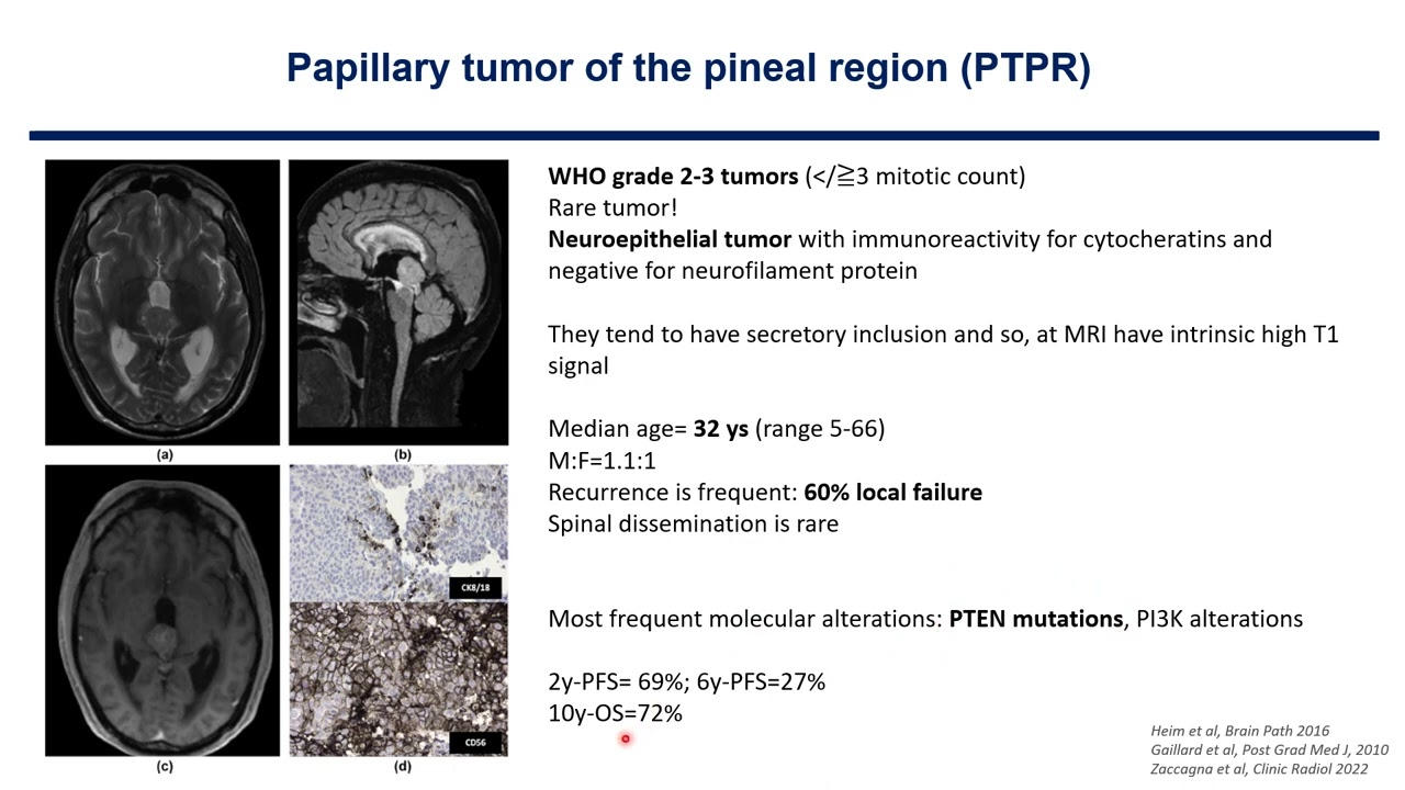 EURACAN - Pineal tumors