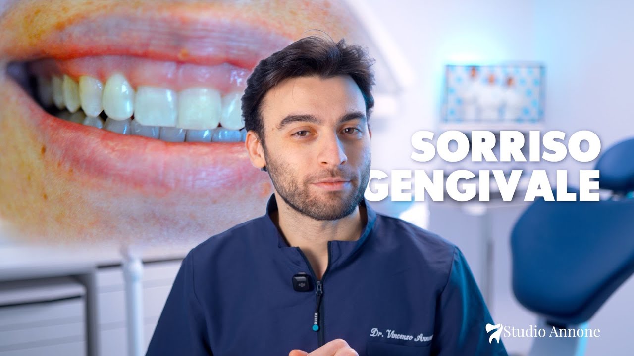 Il sorriso gengivale, come correggerlo | Dr. Vincenzo Annone