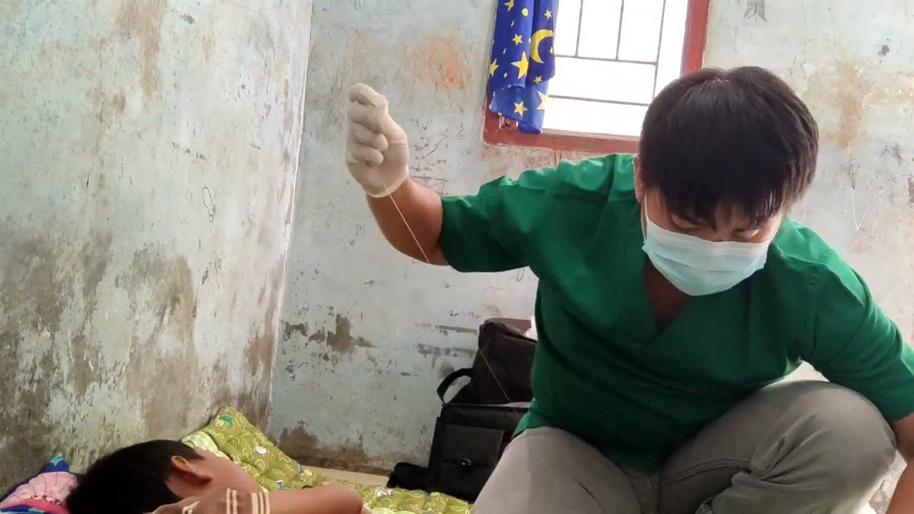 sunat berbagi, sunat tanpa jarum suntik