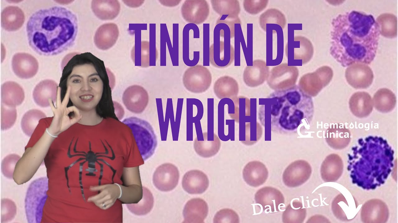 Tincion de wright