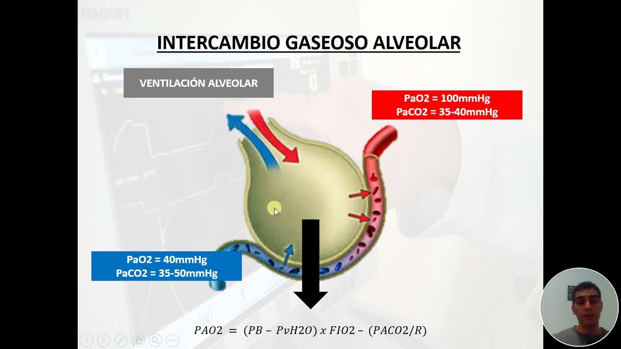 Monitoreo de la Ventilación Mecánica I