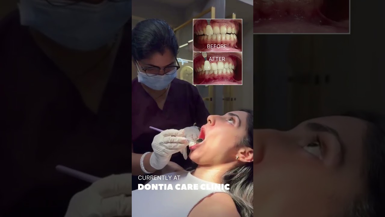 Bright and shiny teeth | Dontia Dental Care Kolkata 