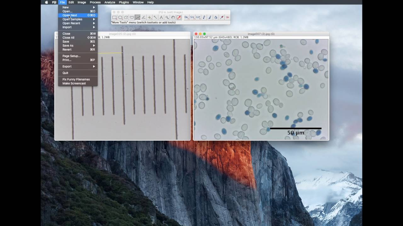 Using imageJ to measure cells and add scale bars