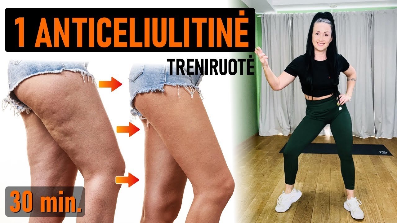 1 anticeliulitinė treniruotė. Metame svorį, mažiname celiulitą 📣