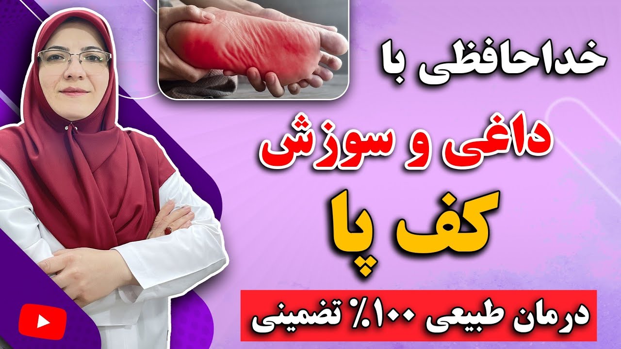 علت و درمان سوزش و داغی کف پا در شب چیست؟ | درمان 💯 تضمینی داغی کف پا در خانه