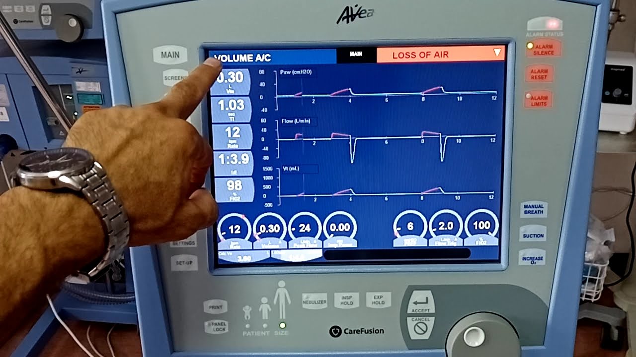 الجزء الرابع ضبط اعدادت جهاز التنفس الصناعيPart IV Adjusting the settings of the ventilator
