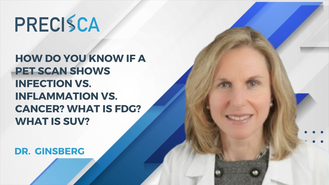 How do you know if a PET scan shows infection vs. inflammation vs. cancer? What is FDG? What is SUV?