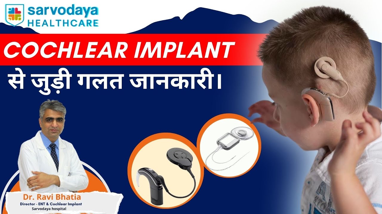 Cochlear Implant से जुड़ी गलत जानकारी। | #cochlear #implant #ears #hearing #earproblems #doctor