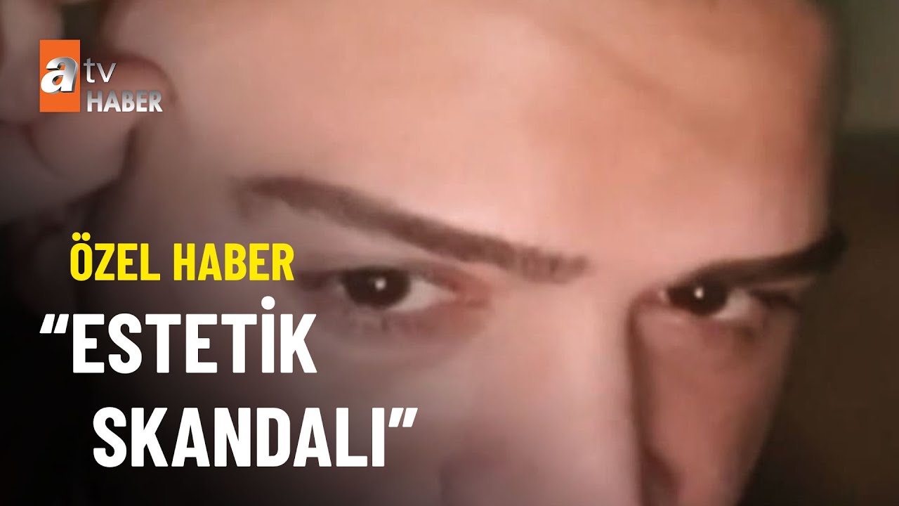 Alnına göğüs dolgusu enjekte edildi  - atv Haber 26 Temmuz 2022