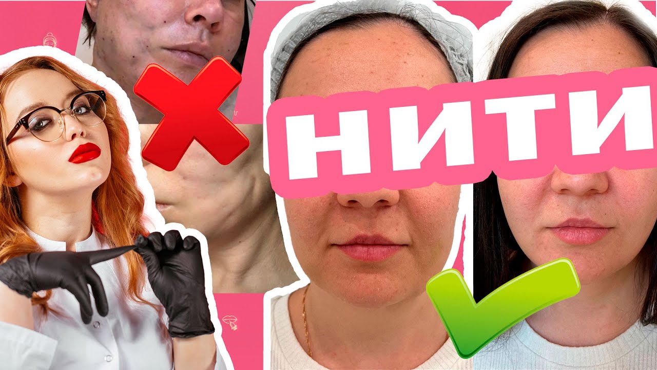 УЗНАЙ ТРИ СЕКРЕТА и НИТИ ПОДТЯНУТ ЛИЦО!