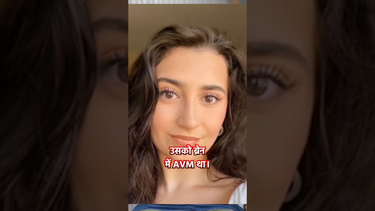 Young Girl Died due to Brain AVM 🤯 Why & How?? #brainstroke #avm